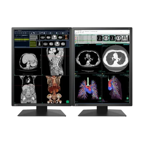 Medical Monitor EIZO Radi Force RX270 - 21.3