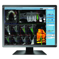 Medical Monitor EIZO RadiForce MX216-HB 2MP, Color